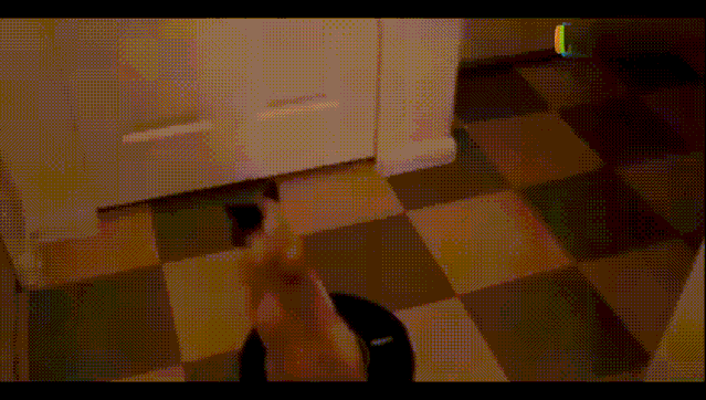 全国首例！我自主研发机器人辅助完成全脑血管造影手术